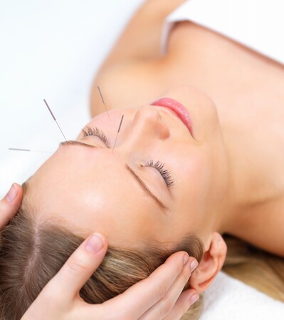 Cosmetische acupunctuur